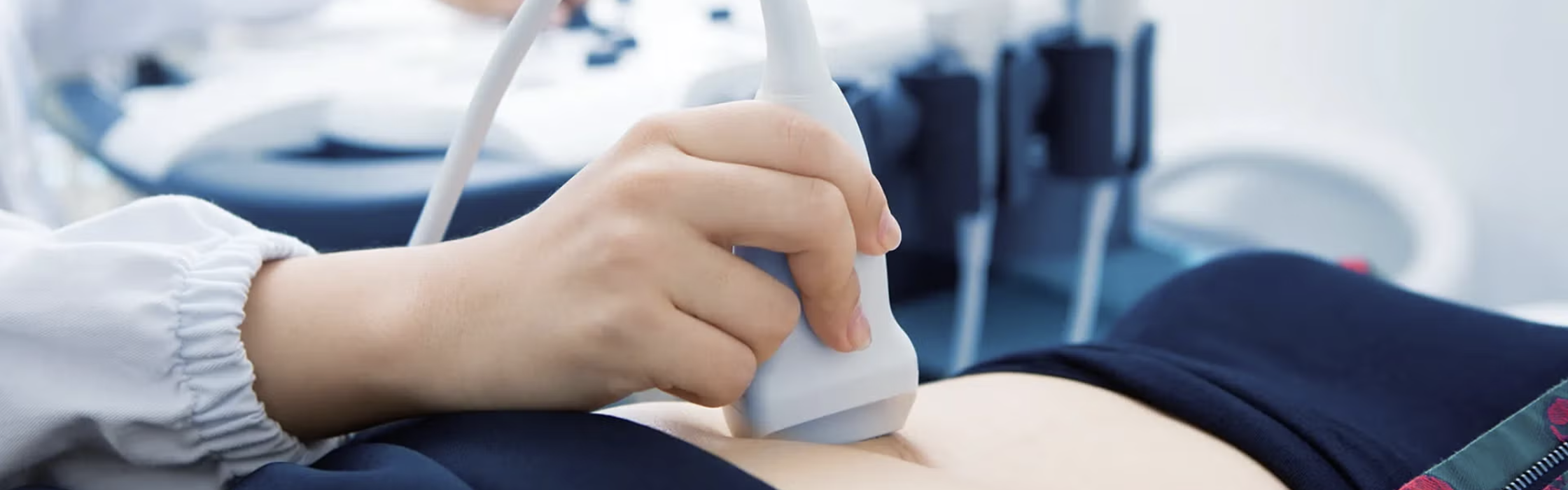 Ärztliche Ultraschalluntersuchung am Bauch einer Patientin  