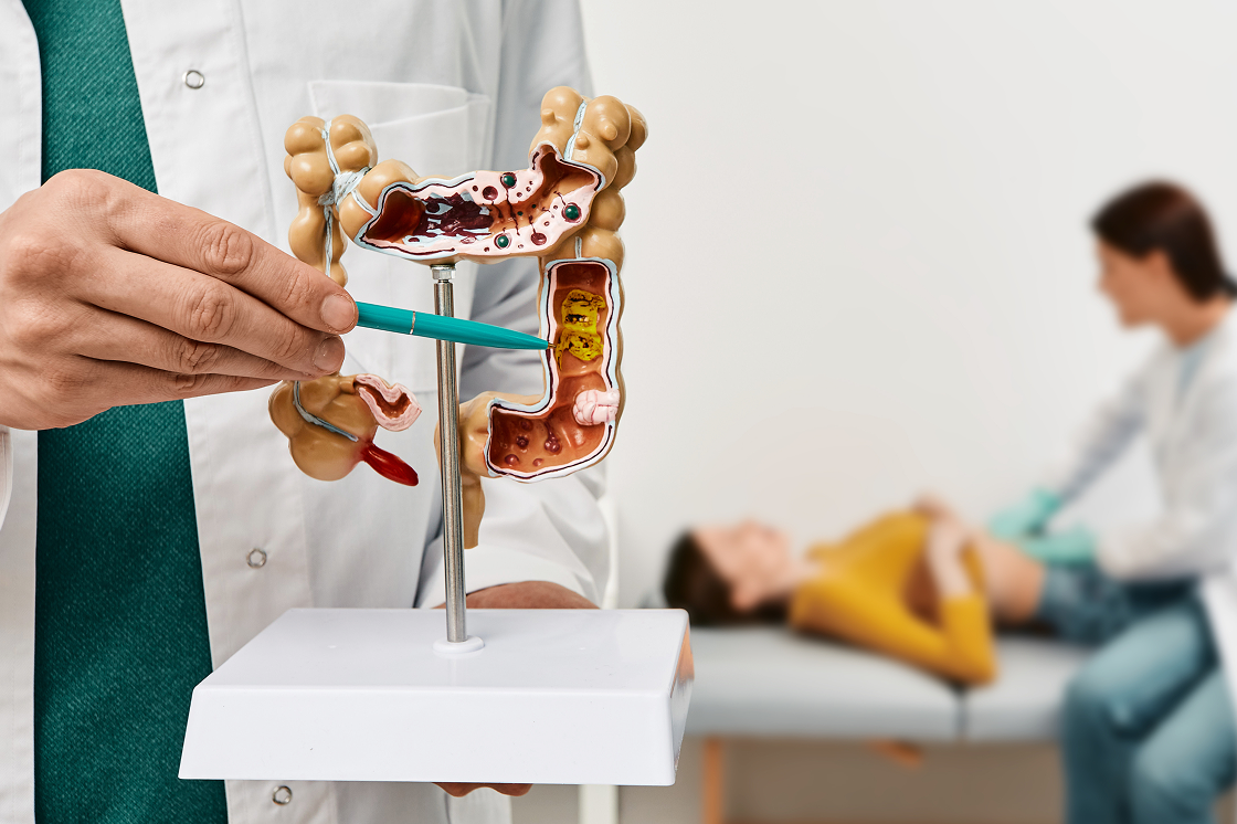 Arzt zeigt mit Kugelschreiber auf Modell eines Darms, im Hintergrund tastet Ärztin den Bauch einer Patientin ab